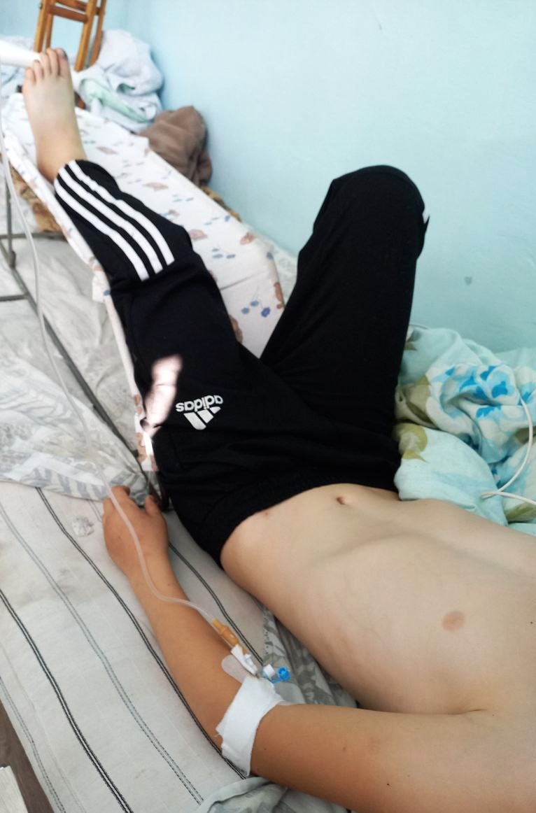 В Бурятии врачи спасли 10-летнего мальчика после укуса гадюки В Бурятии врачи спасли 10-летнего мальчика после укуса гадюки
