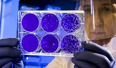 В Бурятии больше 600 человек вылечились от коронавируса