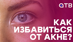 Как избавиться от акне? Готовимся к выпускным вместе с «Бьюти-юти» на АТВ